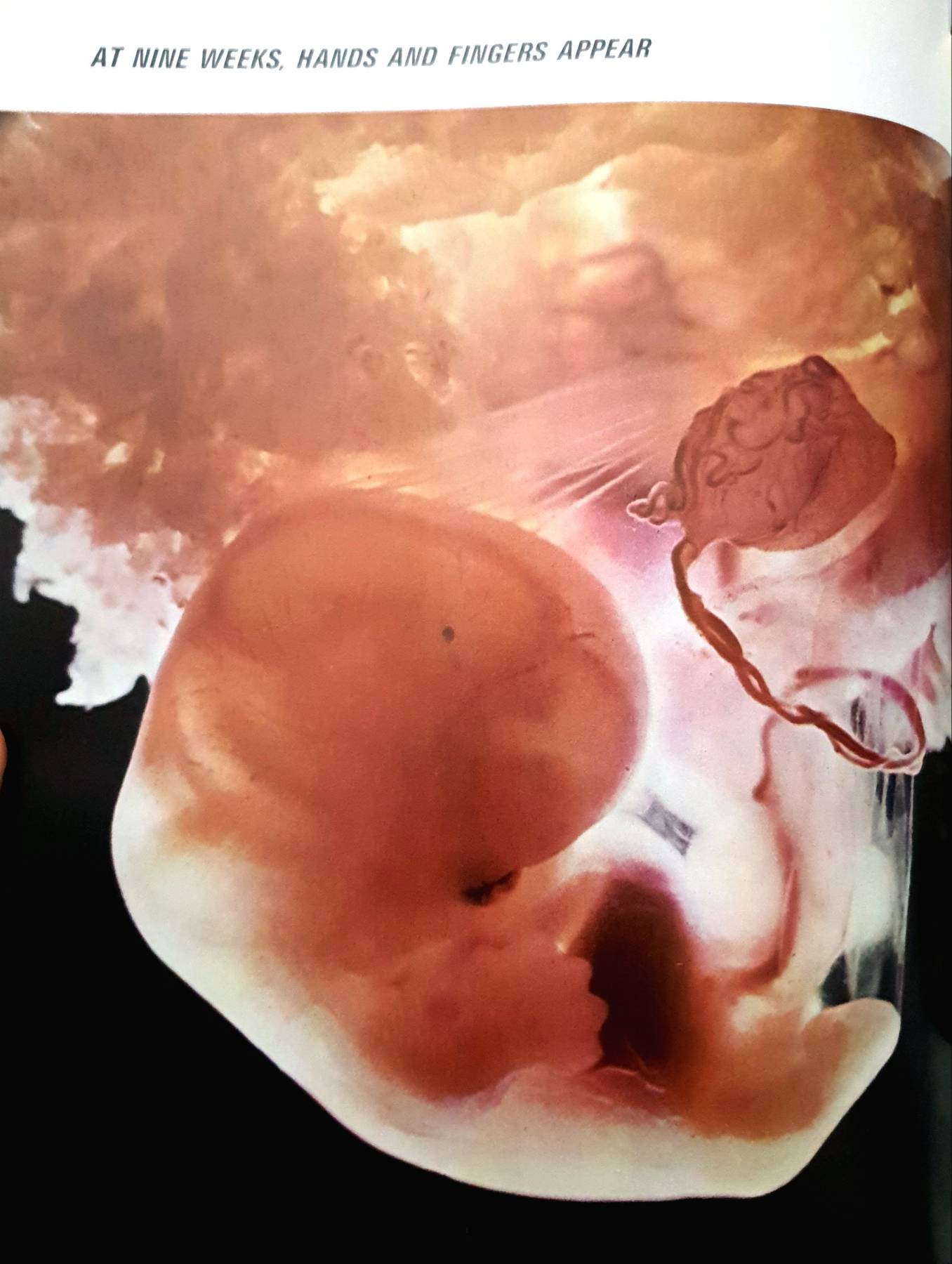 Growth (Life science library) : J. M Tanner