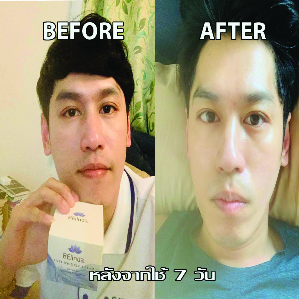 Belinda anti wrinkle cream,ครีมลดริ้วรอย ,ผิวเรียบเนียน,ขาวกระจ่างใส,ลดเลือนริ้วรอย,ช่วยเติมเต็มร่องลึกให้กับผิว,ช่วยให้ผิวกระชับ,เต่งตึง,ดูอ่อนเยาว์