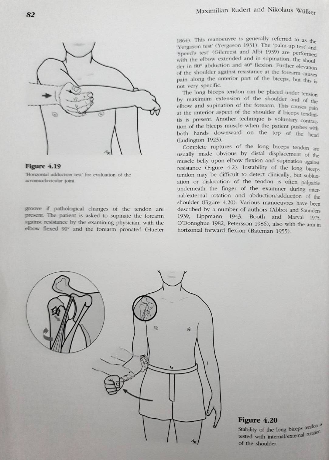 Shoulder Surgery : An Illustrated Textbook (Hardcover) : Nikolaus Wulker