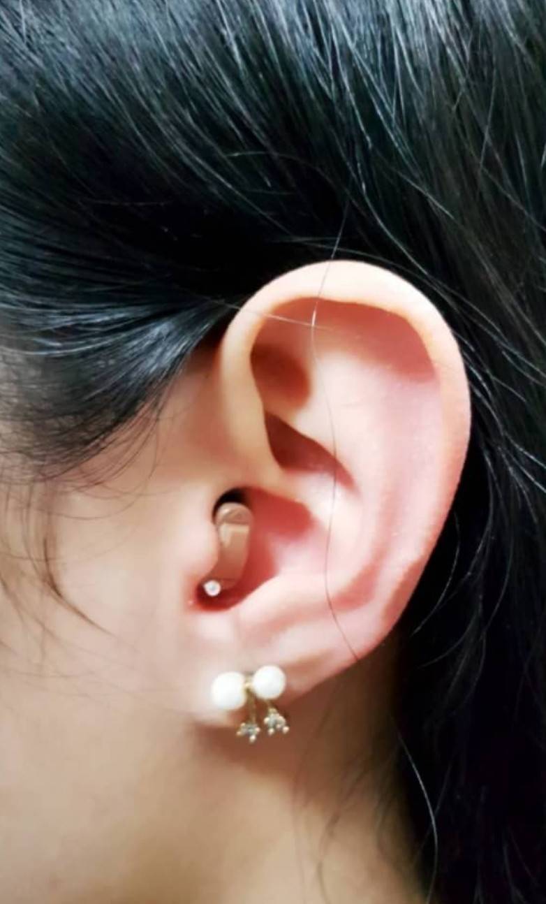 เครื่องช่วยฟัง Signia RUN click R(ขวา) หูตึงเล็กน้อย > ปานกลาง