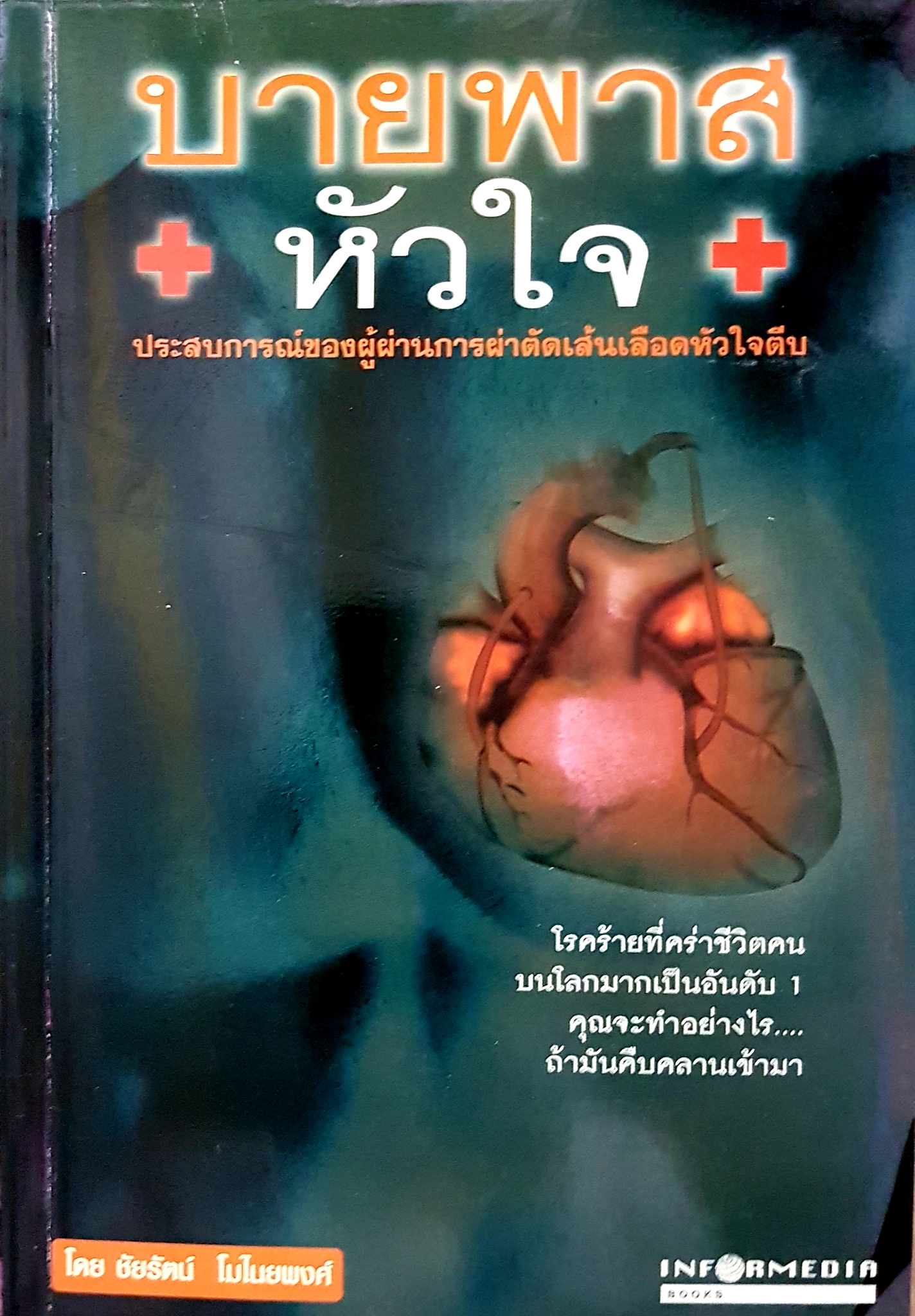 บายพาส หัวใจ โดย ชัยรัตน์ โมไนยพงศ์