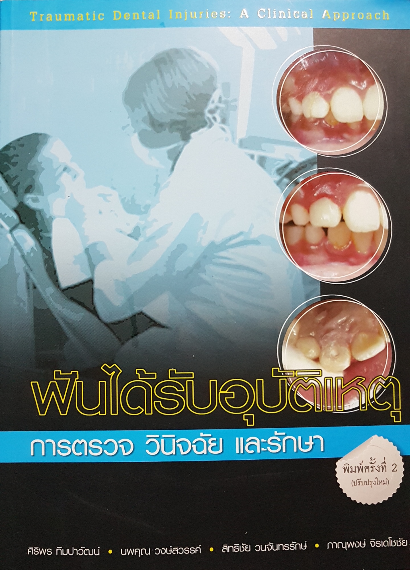 ฟันได้รับอุบัติเหตุ การตรวจ วินิจฉัย และรักษา