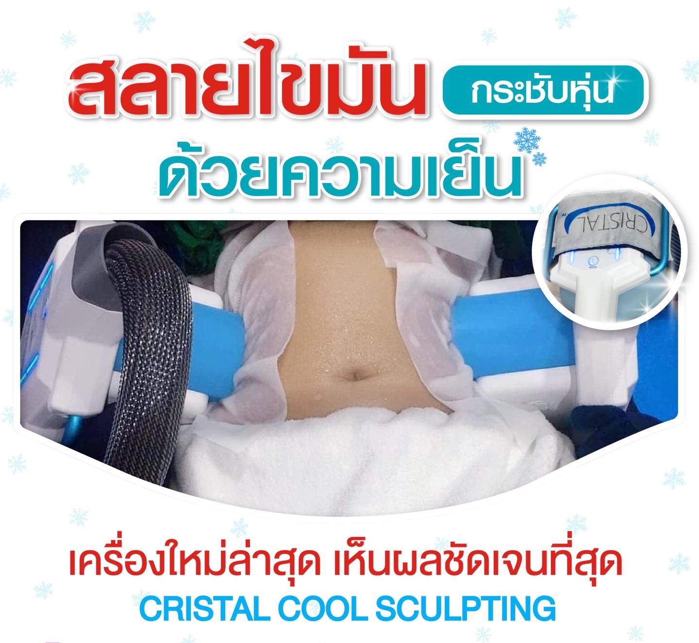 [E-Voucher] เครื่องลดไขมัน ด้วยความเย็นจุดเยือกแข็ง - CRISTAL COOL