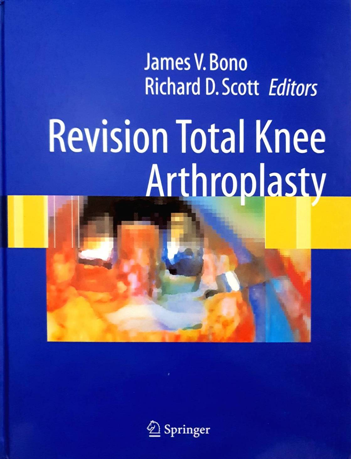 Revision Total Knee Arthroplasty : (Hardcover) James V. Bono