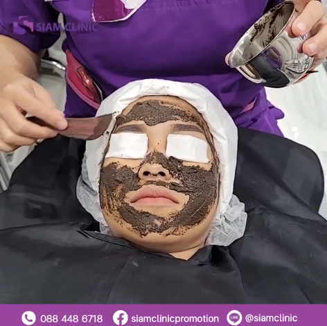 [E-Voucher] โปรแกรมรักษาฝ้าด้วยมาส์กจากเปลือกต้นสน - Melasma Pine Tree