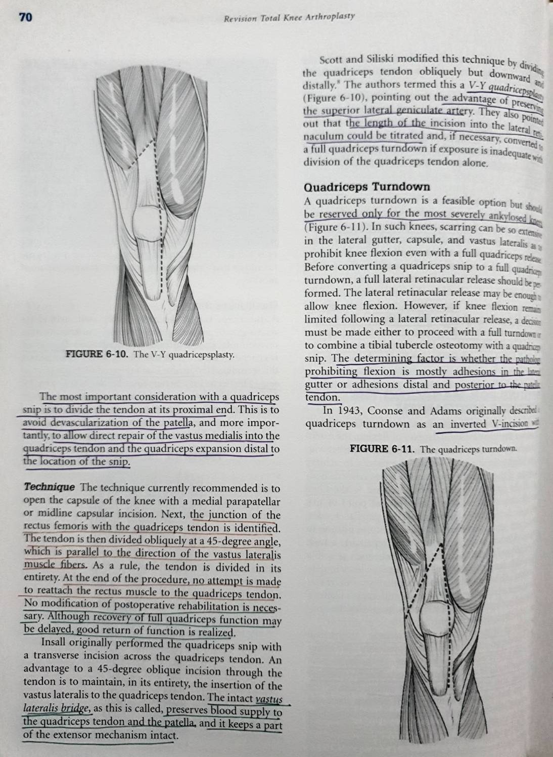 Revision Total Knee Arthroplasty : (Hardcover) James V. Bono