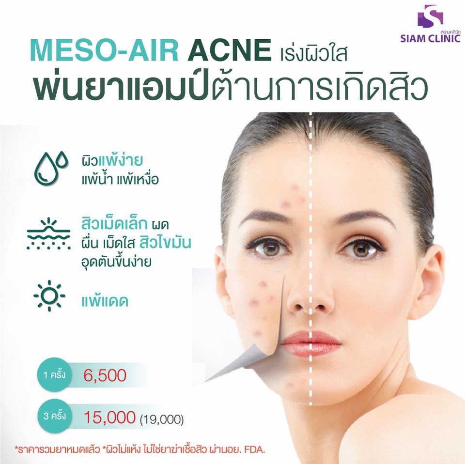[E-Voucher] โปรแกรมเร่งผิวใส พ่นยาต้านการเกิดสิว - Meso Air Acne