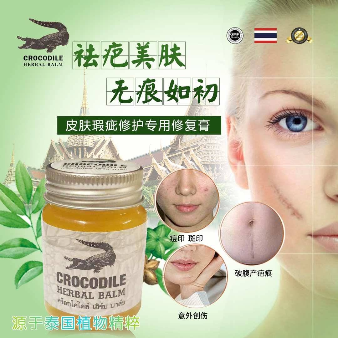 ยาหม่องจระเข้ 鳄鱼祛疤膏