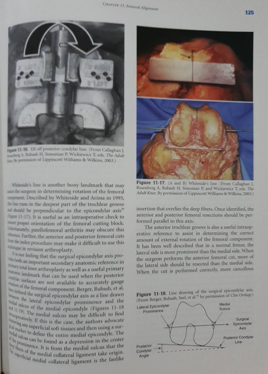 Revision Total Knee Arthroplasty : (Hardcover) James V. Bono