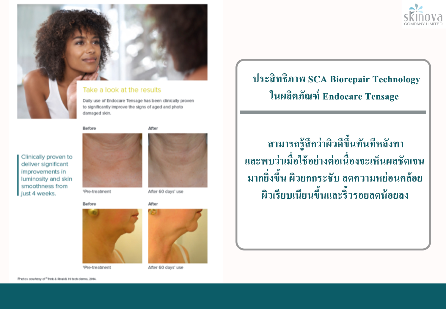 Endocare Tensage Serum เซรั่มกระตุ้นการสร้างคอลลาเจน ลดริ้วรอย ยกกระชับ