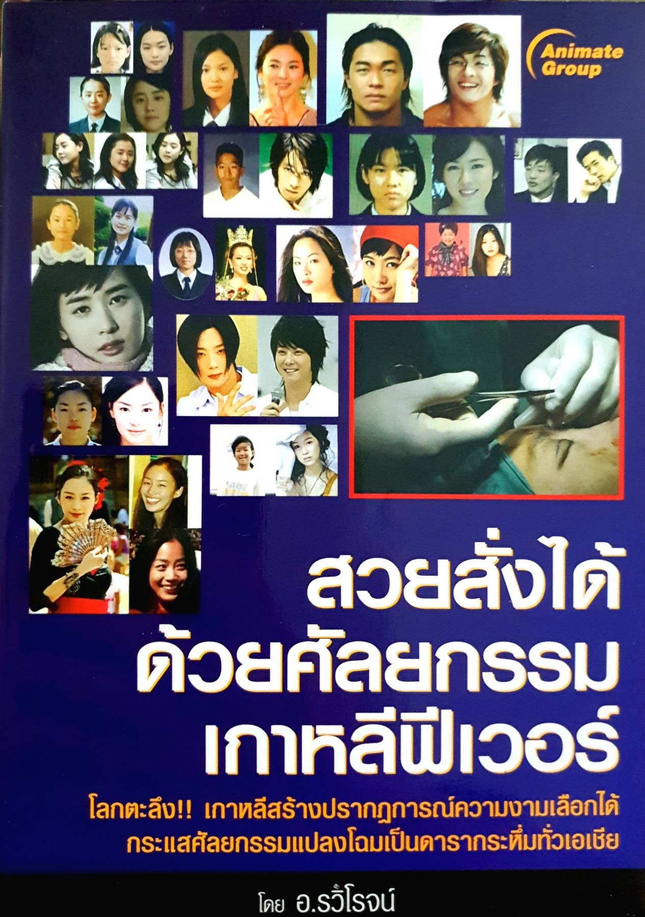 สวยสั่งได้ ด้วยศัลยกรรมเกาหลีฟีเวอร์
