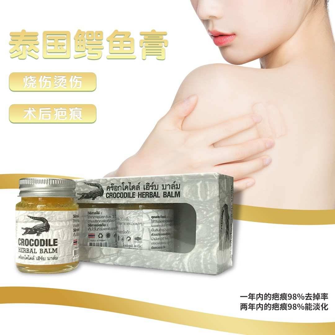 ยาหม่องจระเข้ 鳄鱼祛疤膏