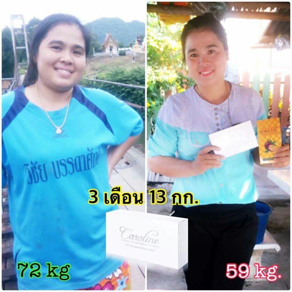 ดีท็อกซ์,detox,PACIO,PACIO DETOX,พาซิโอ้ ดีท็อกซ์,ล้างลำไส้,ล้างไขมัน,ลดพุง,ลดน้ำหนัก,ลดความอ้วน,มะเร็งลำไส้,ขับถ่าย,ล้างสารพิษ PACIO,พาซิโอ้,ดีท็อกซ์,ล้างลำไส้,ช่วยระบบขับถ่าย,มะเร็งลำไส้