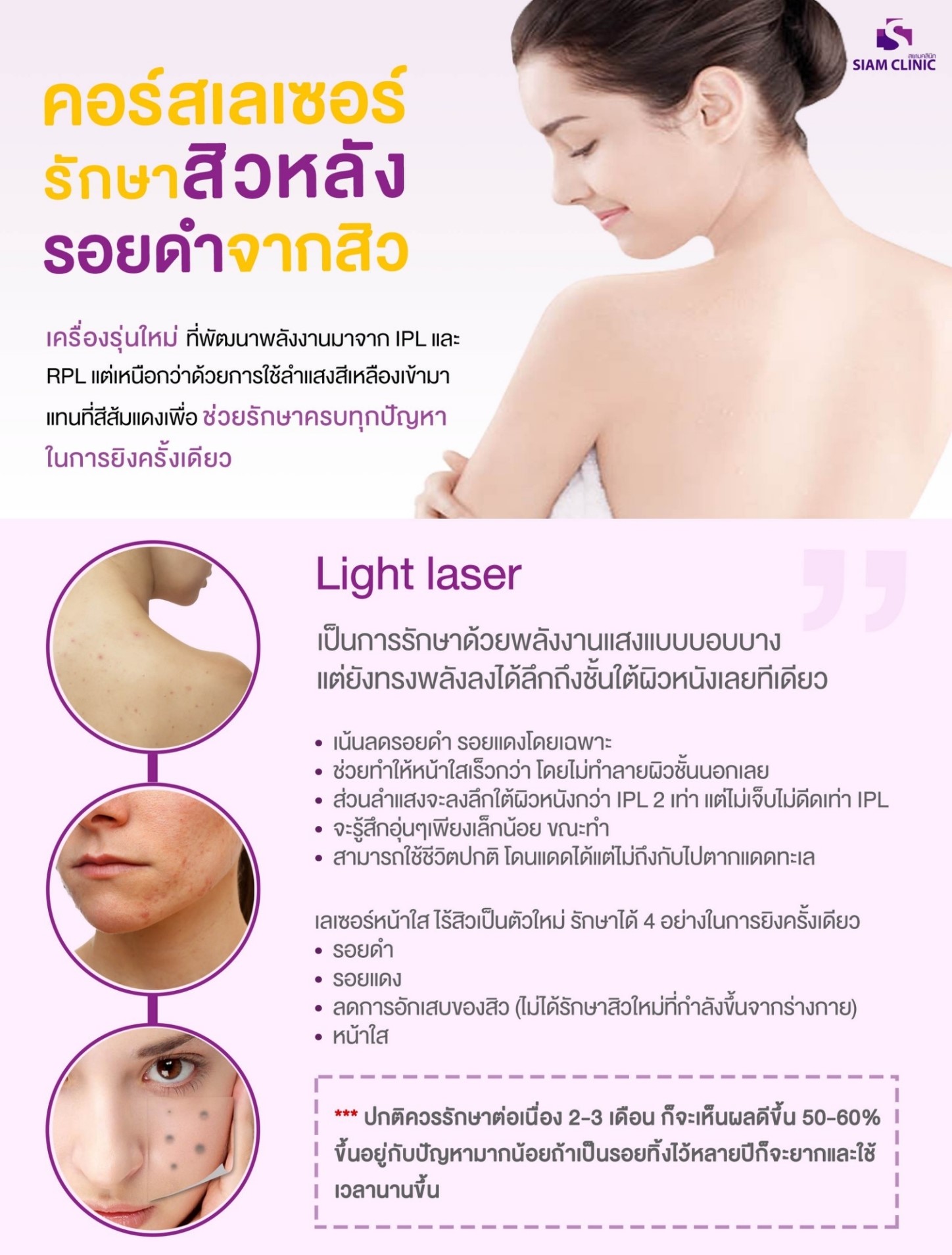 [E-Voucher] โปรแกรมเลเซอร์รักษาสิวหลัง รอยดำจากสิว - Laser