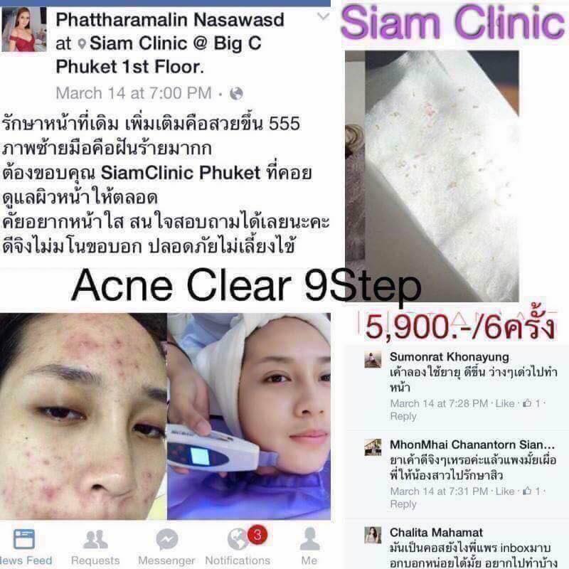 [E-Voucher] โปรแกรมรักษาปัญหาสิว 10 ขั้นตอน - Acne Program II
