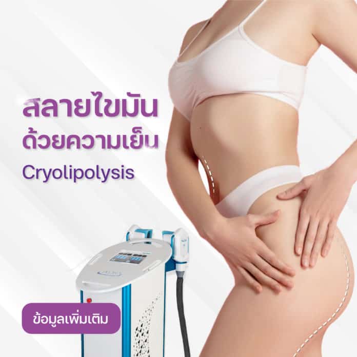[E-Voucher] เครื่องลดไขมัน ด้วยความเย็นจุดเยือกแข็ง - CRISTAL COOL