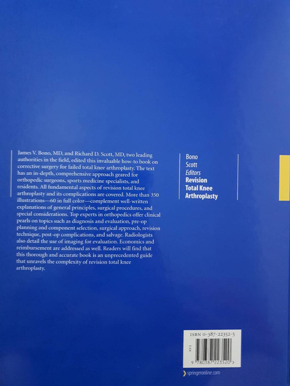 Revision Total Knee Arthroplasty : (Hardcover) James V. Bono