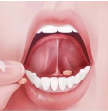 Oxithion (ออกซิไธออน) กลูต้าไธโอน แบบเม็ดอมใต้ลิ้น บำรุงผิวหมองคล้ำให้ขาวใส