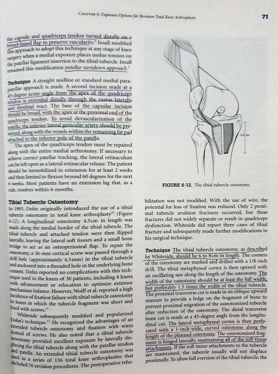 Revision Total Knee Arthroplasty : (Hardcover) James V. Bono