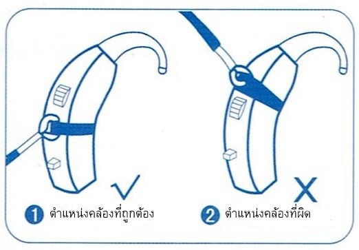 Binaural BTE Clip SiundLink ป้องกันเครื่องช่วยฟังหล่นหาย แบบใส่ 2 ข้าง