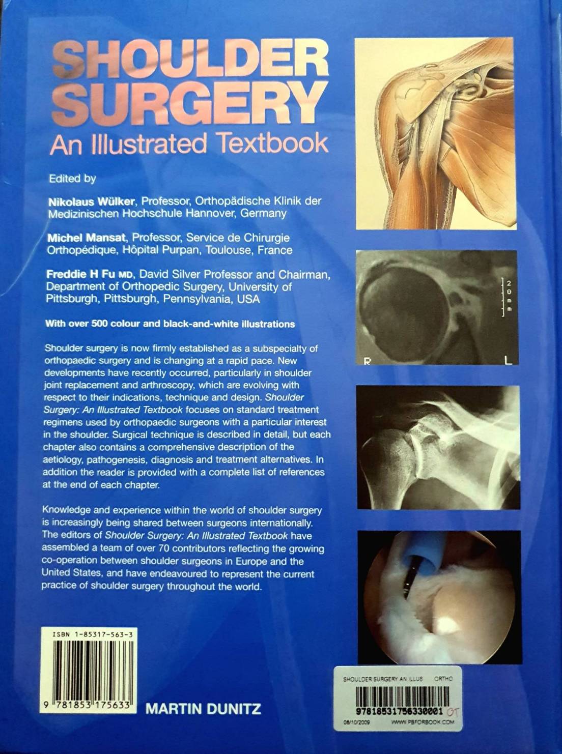 Shoulder Surgery : An Illustrated Textbook (Hardcover) : Nikolaus Wulker