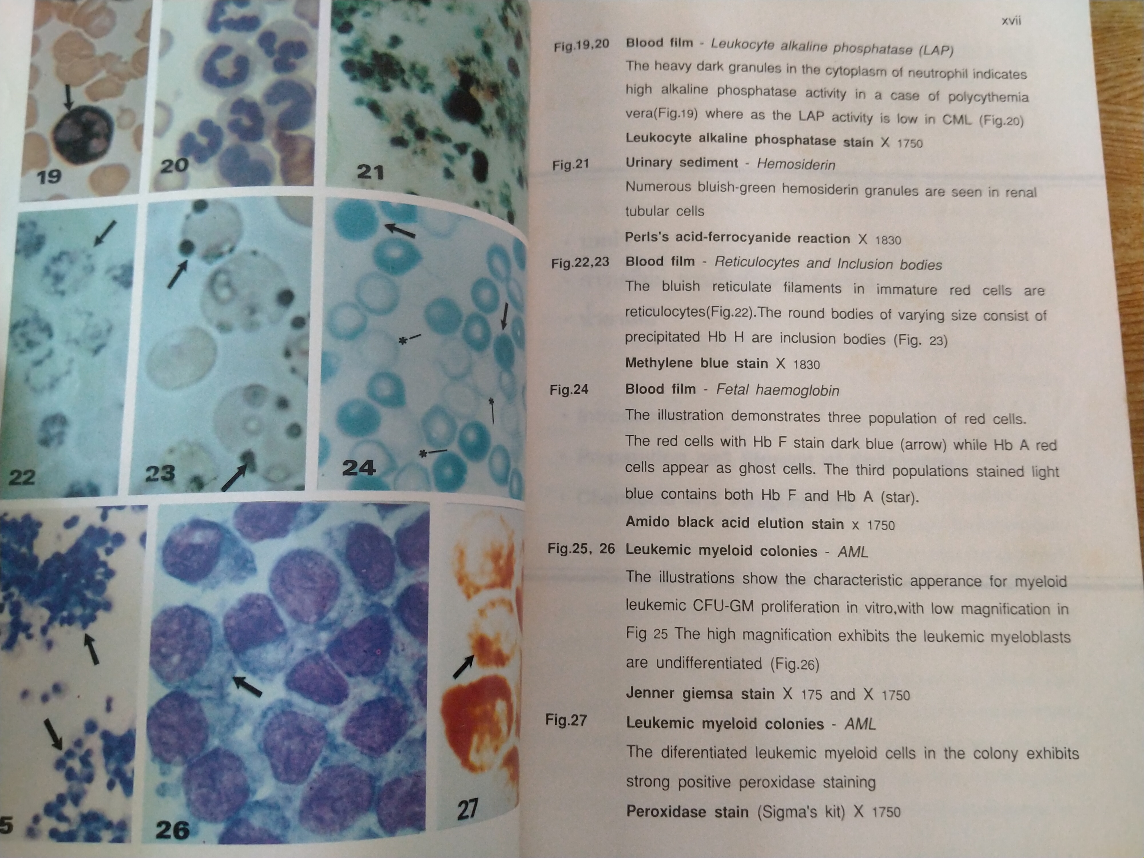 ถาม - ตอบ เซลล์เคมีเม็ดเลือด