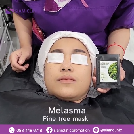 [E-Voucher] โปรแกรมรักษาฝ้าด้วยมาส์กจากเปลือกต้นสน - Melasma Pine Tree
