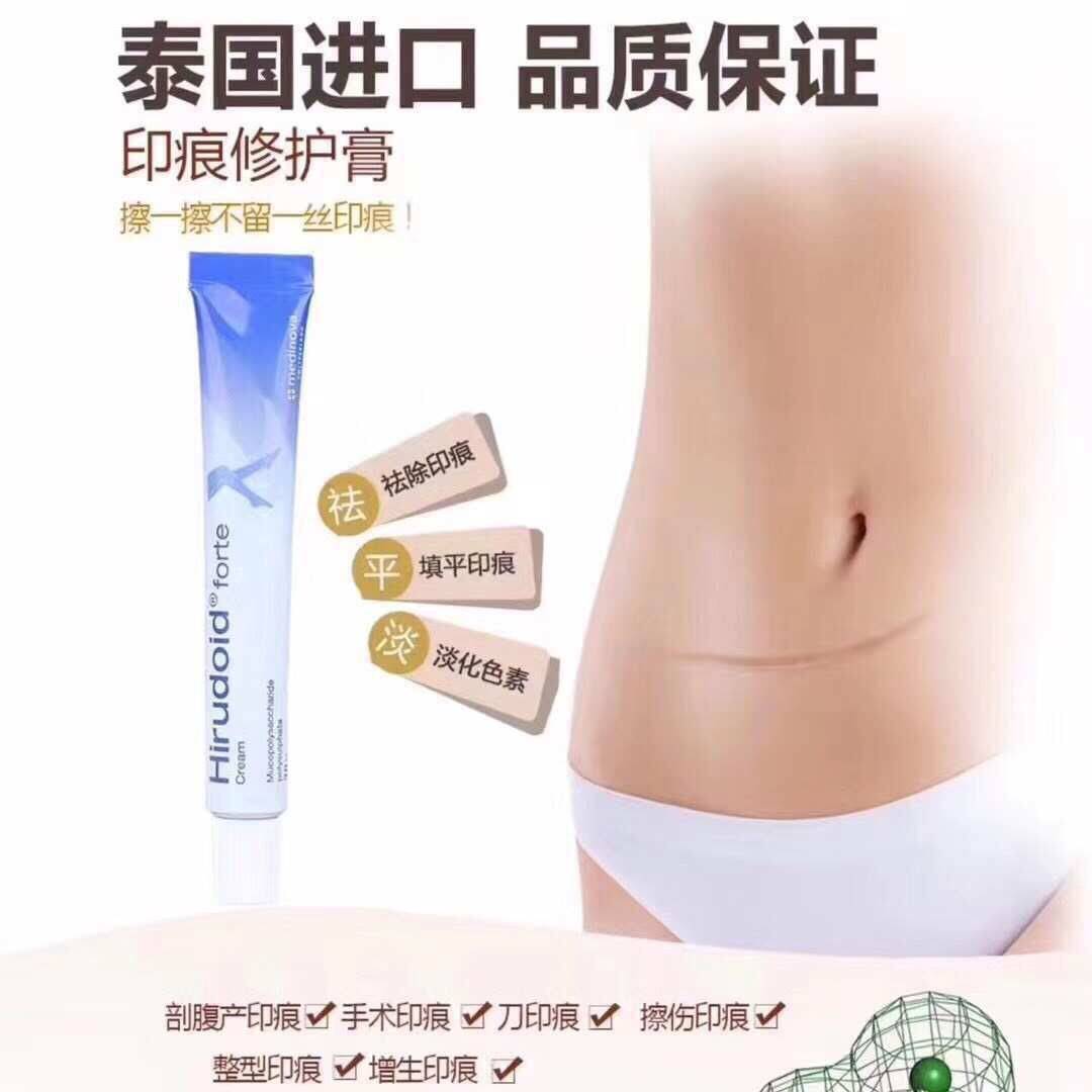 Hirudoid Forte ครีมลดรอบฟกช้ำ