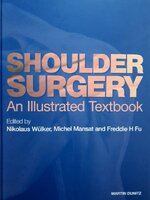 Shoulder Surgery : An Illustrated Textbook (Hardcover) : Nikolaus Wulker