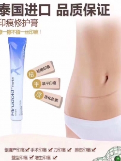 Hirudoid Forte ครีมลดรอบฟกช้ำ