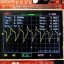 DSO138+Adapter+BNC สาย